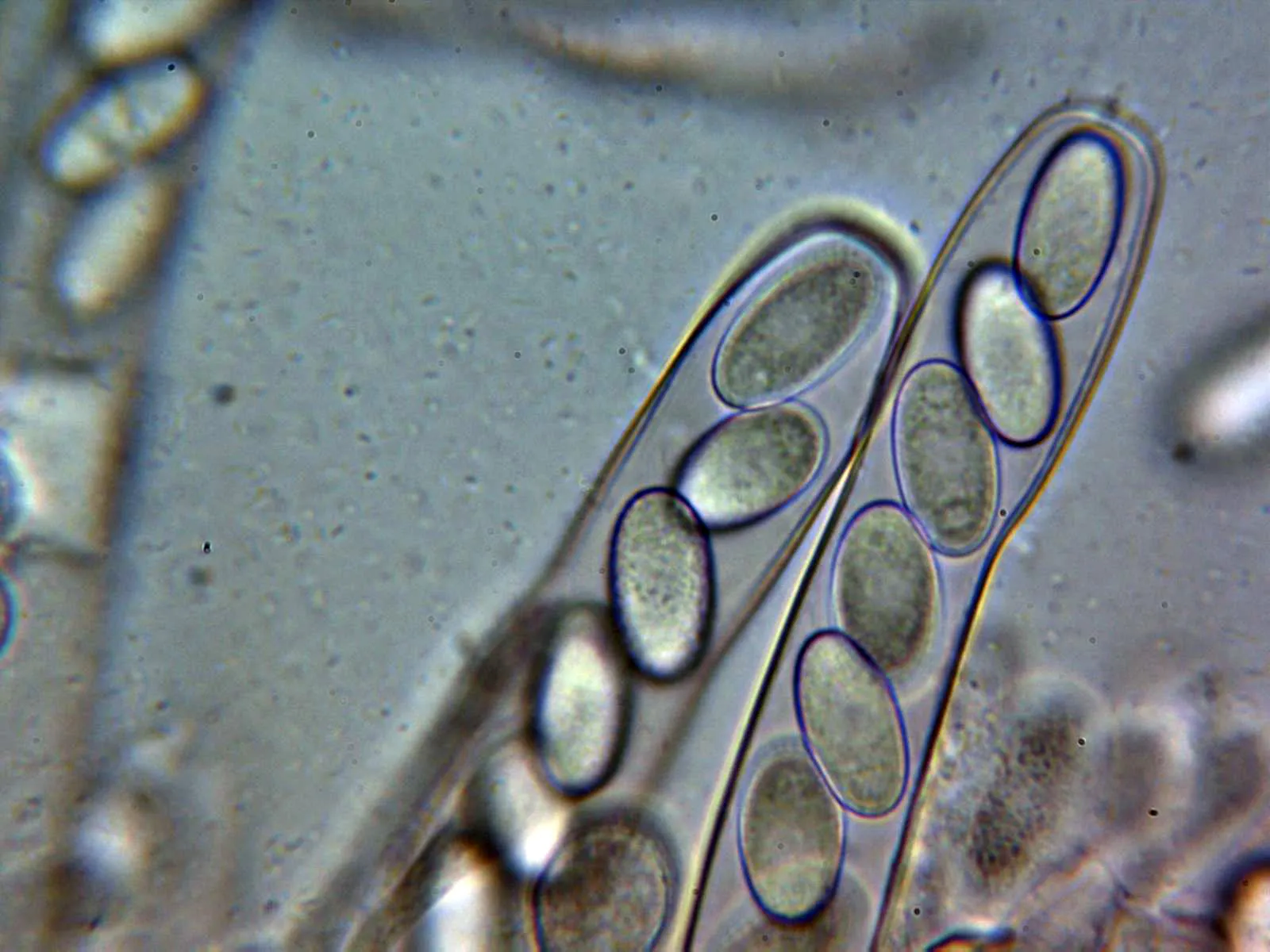 Microscopía de Peziza arvernensis - 10 - Ascas 1